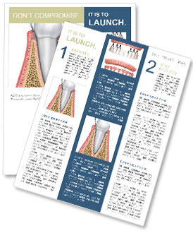 Managing Periodontitis: Tips And Methods Newsletter Template