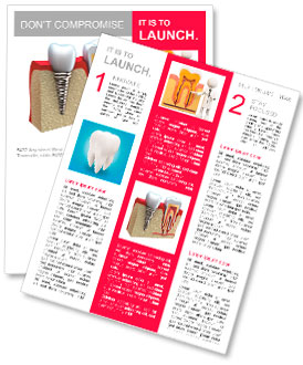 Anatomy of healthy teeth and dental implant in jaw bone. Newsletter Template