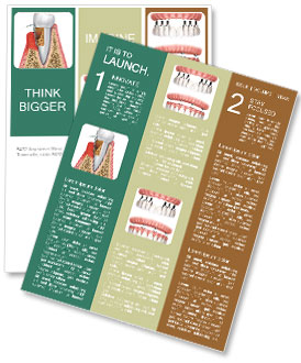 Understanding The Different Stages Of Periodontal Disease Newsletter Template